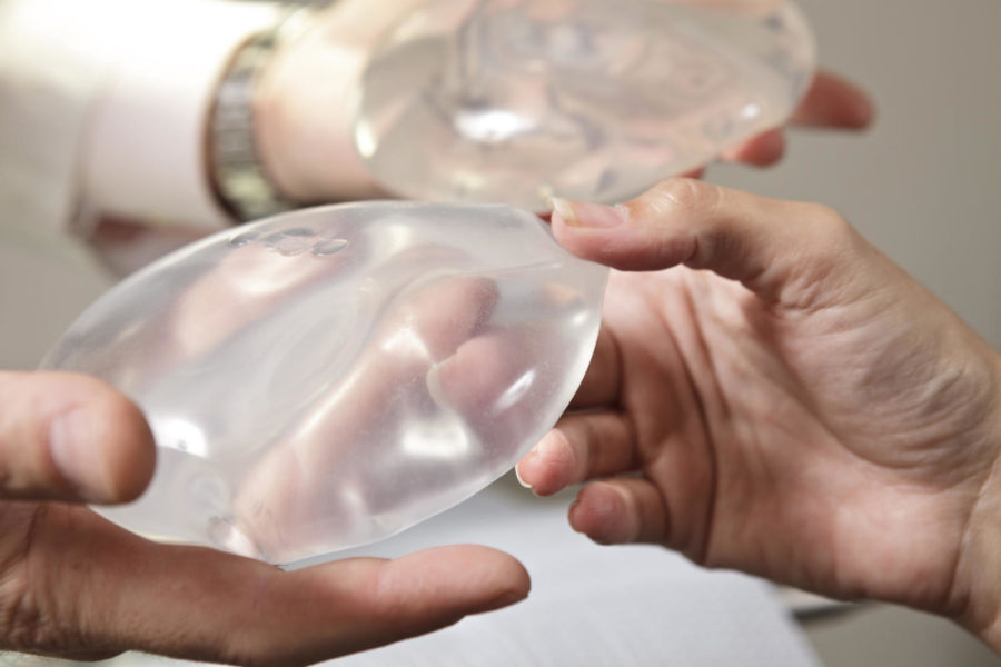 Columnist Brase points out the negatives of breast implants including health dangers such as breast pain and chest wall deformity.